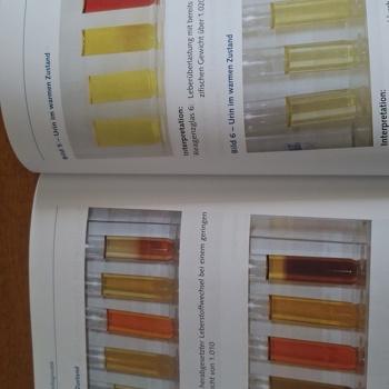 Traditionelle Urin-Funktionsdiagnostik Bild 3