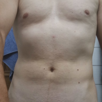Suche Frau für Sex und und Bild 3